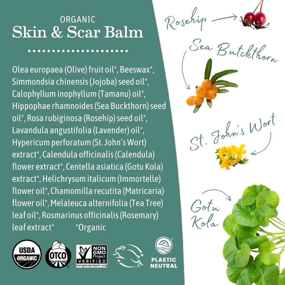 Earth Mama Organic Skin & Scar Balm |C-Section Recovery Skin Care, Pregnancy Stretch Mark Scar Cream with Organic Jojoba Oil, Tamanu Oil & Gotu Kola (2-Pack)