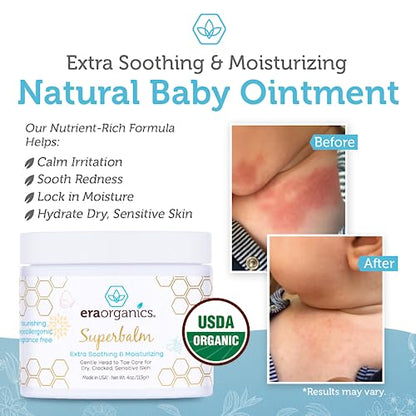 Era Organics Healing Ointment for Babies - USDA Certified Organic Natural Moisturizer Gentle on Sensitive Skin Prone To Baby Eczema, Cradle Cap (Infant Seborrheic Dermatitis), Rashes, Hives and More