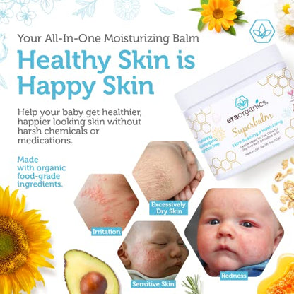 Era Organics Healing Ointment for Babies - USDA Certified Organic Natural Moisturizer Gentle on Sensitive Skin Prone To Baby Eczema, Cradle Cap (Infant Seborrheic Dermatitis), Rashes, Hives and More