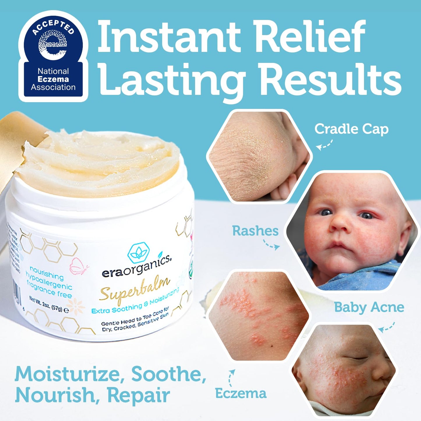 Era Organics Healing Ointment for Babies - USDA Certified Organic Natural Moisturizer Gentle on Sensitive Skin Prone To Baby Eczema, Cradle Cap (Infant Seborrheic Dermatitis), Rashes, Hives and More