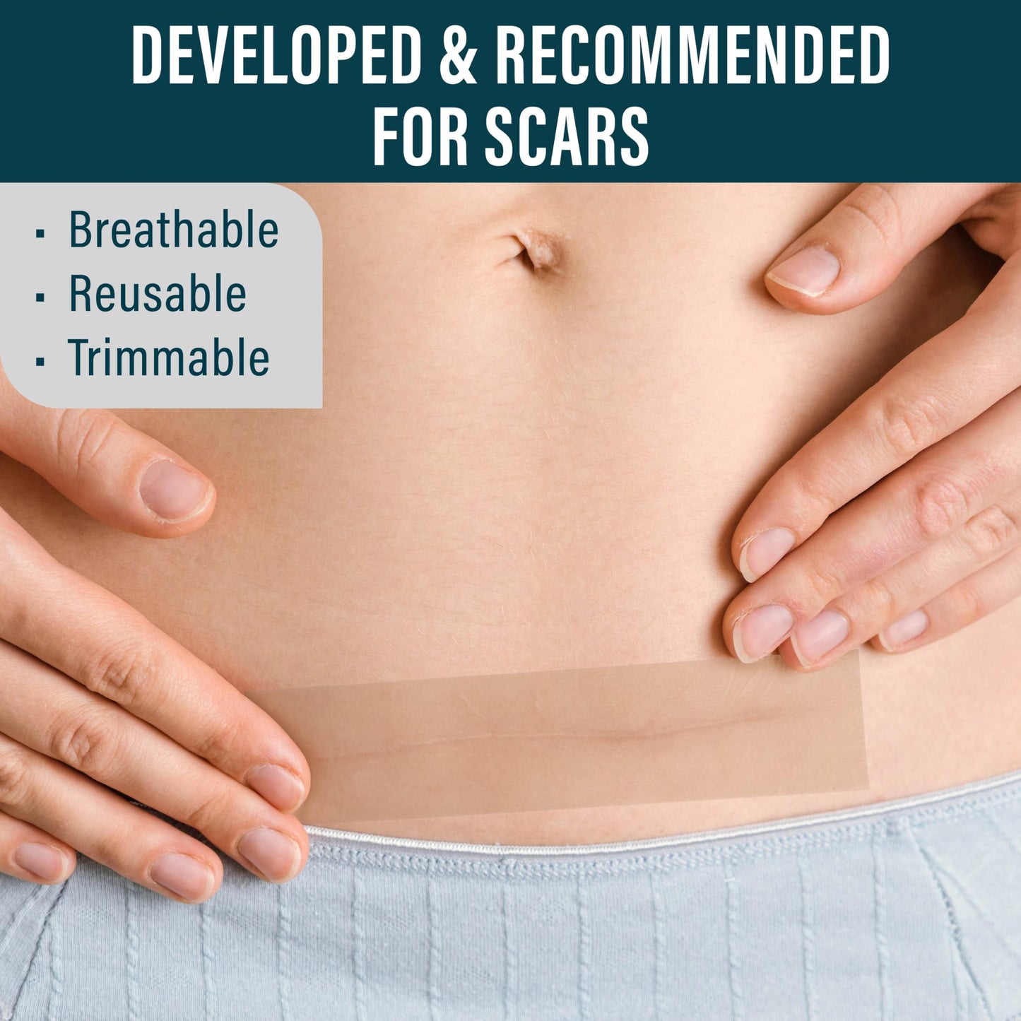 NUVADERMIS Silicone Scar Sheets - Extra Long Scar Sheets for C-Section, Tummy Tuck, Keloid, and Surgical Scars - Reusable Medical Grade Silicone Scar Sheets - Pack of 4 - Light Tone