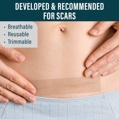NUVADERMIS Silicone Scar Sheets - Extra Long Scar Sheets for C-Section, Tummy Tuck, Keloid, and Surgical Scars - Reusable Medical Grade Silicone Scar Sheets - Pack of 4 - Light Tone