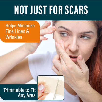NUVADERMIS Silicone Scar Sheets - Extra Long Scar Sheets for C-Section, Tummy Tuck, Keloid, and Surgical Scars - Reusable Medical Grade Silicone Scar Sheets - Pack of 4 - Light Tone