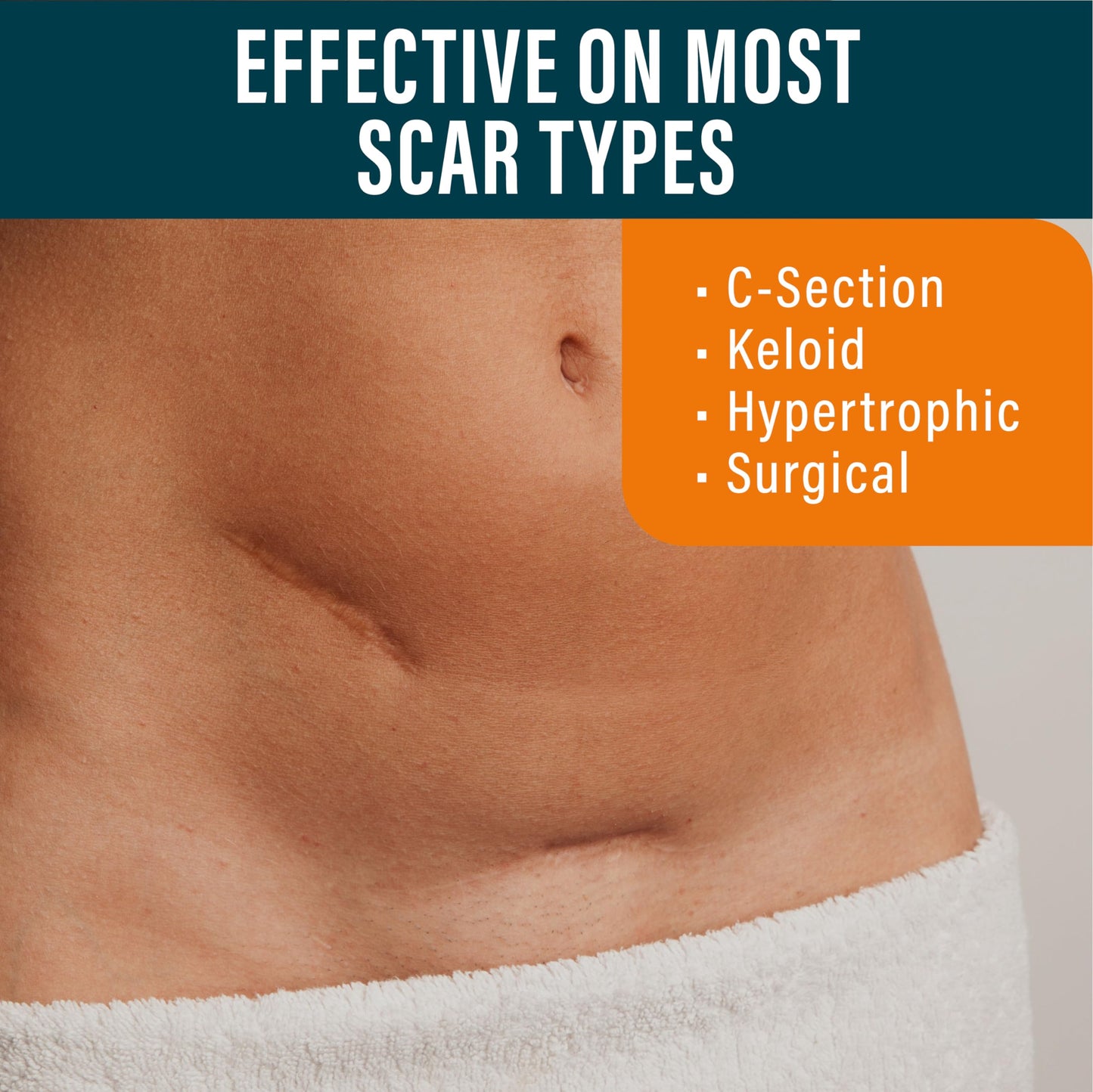 NUVADERMIS Silicone Scar Sheets - Extra Long Scar Sheets for C-Section, Tummy Tuck, Keloid, and Surgical Scars - Reusable Medical Grade Silicone Scar Sheets - Pack of 4 - Light Tone