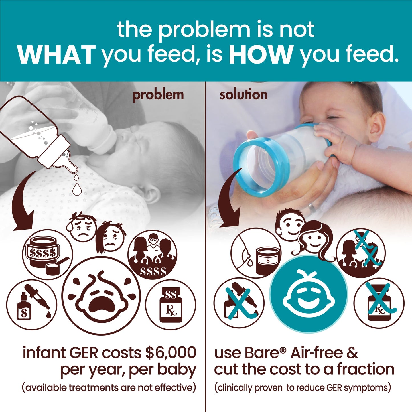 The Upright Bottle Bittylab Bare Air-Free 4oz Single for breastmilk or Baby Formula, Anti-Reflux, Anti-Colic, Anti-Gas, Fuss or Sleep Troubles. with Easy-Latch & Perfe-Latch Nipples. 0-6 Months.